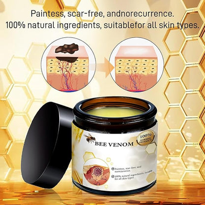 Bee Venom Skin Cream - Bee Venom Skin Treatment Cream For Fast & Gentle Removal