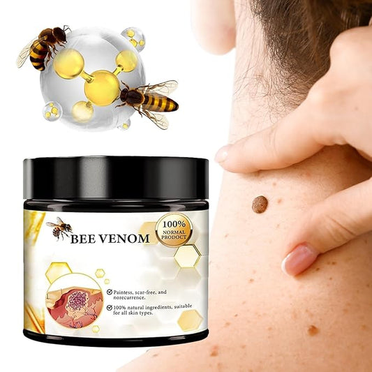 Bee Venom Skin Cream - Bee Venom Skin Treatment Cream For Fast & Gentle Removal