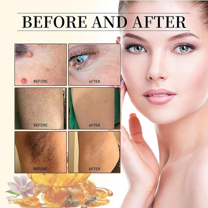Bee Venom Skin Cream - Bee Venom Skin Treatment Cream For Fast & Gentle Removal